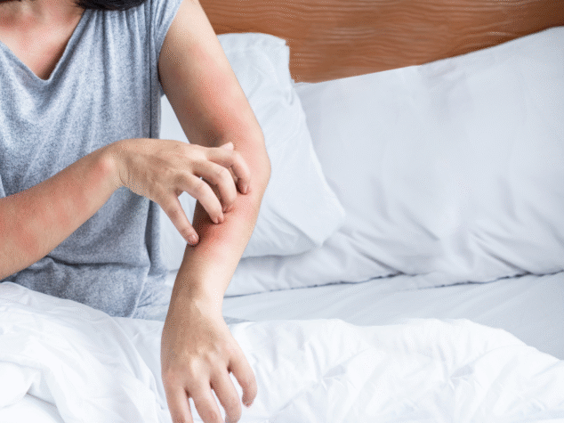 Keep Pests Away {{brizy_dc_image_alt entityId=